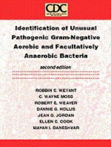 Identification of unusualpathogenic gram - negative aerobic and facultatively  anaerobic bacteria