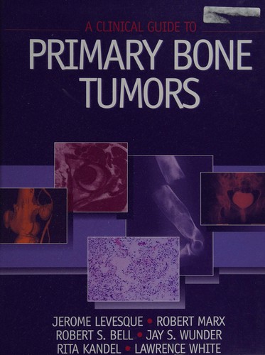 A clinical guide to primary bone tumors