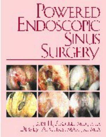 Powered endoscopic sinus surgery